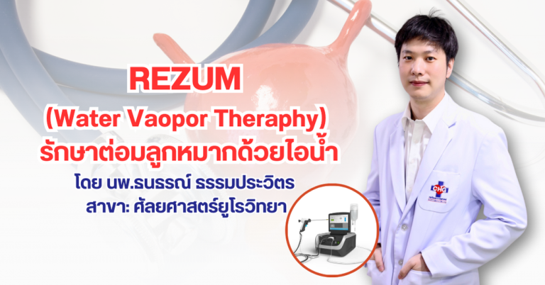 การรักษาโรคต่อมลูกหมากโต Rezum Water Vapor | RYT9