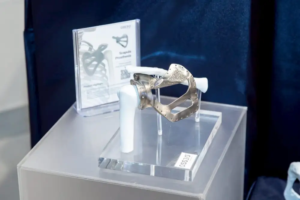 ศิริราชกับความสำเร็จระดับโลก ครั้งแรกในการผลิตกระดูกเบ้าสะโพกไทเทเนียมเฉพาะบุคคล