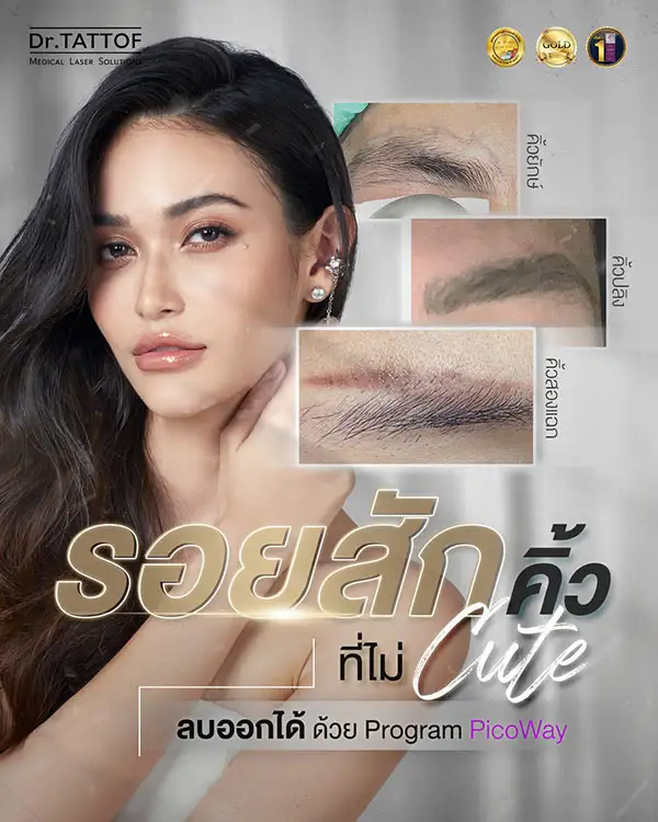 ลบรอยสักคิ้ว ที่ไม่ Cute! ที่ Dr.TATTOF